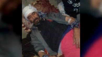 Photo de Un citoyen Sahraoui torturé par les forces d’occupation Marocaine