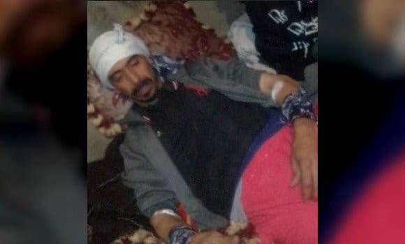 Un citoyen Sahraoui torturé par les forces d’occupation Marocaine